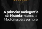 A Primeira Radiografia da História: O Marco que Revolucionou a Medicina