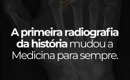 A Primeira Radiografia da História: O Marco que Revolucionou a Medicina