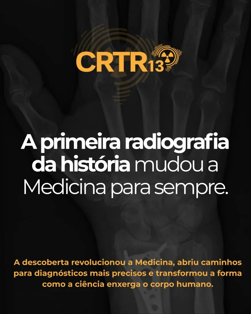 A Primeira Radiografia da História: O Marco que Revolucionou a Medicina