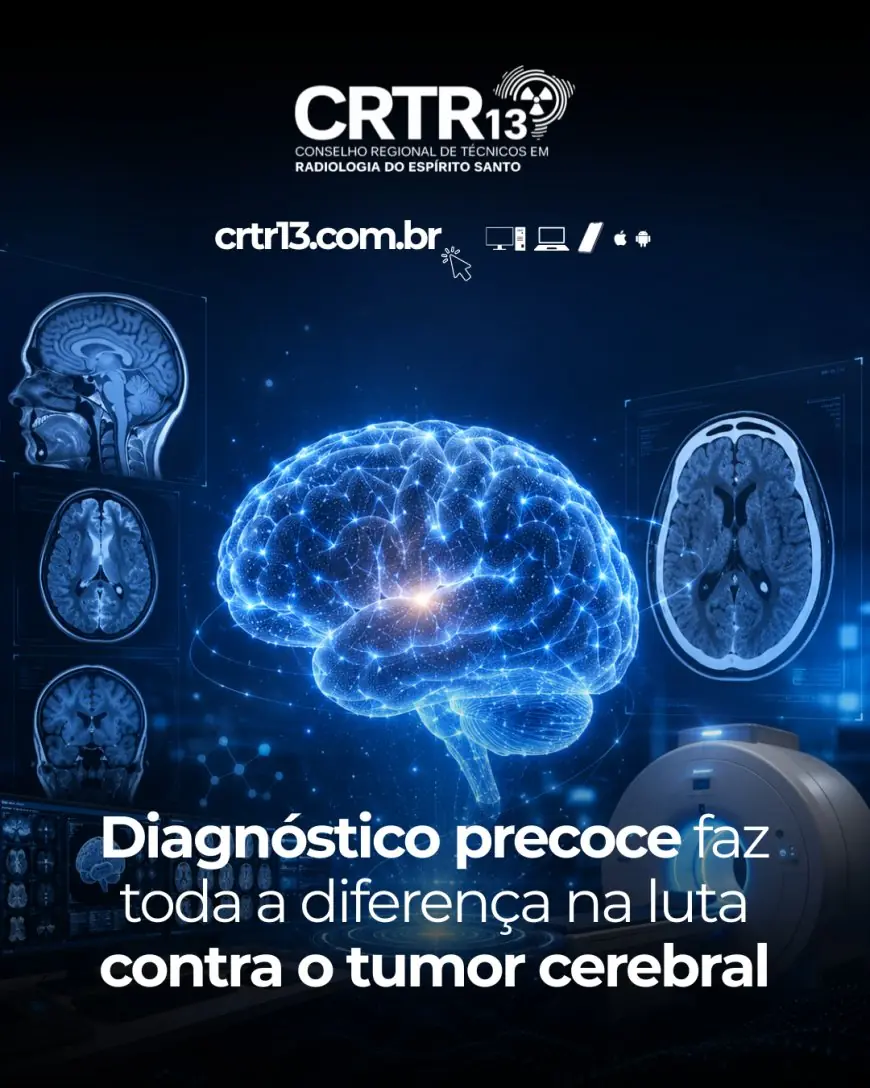 Diagnóstico precoce faz toda a diferença na luta contra o tumor cerebral