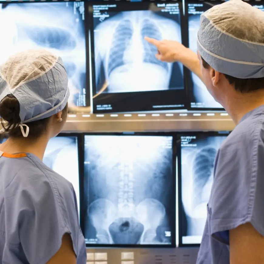 Novo protocolo de tratamento do câncer de pulmão propõe ampliar o acesso à cirurgia torácica assistida por vídeo para pacientes do sistema público de saúde (SUS)